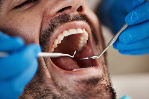 TMJ/TMD Treatment in Egypt, PA